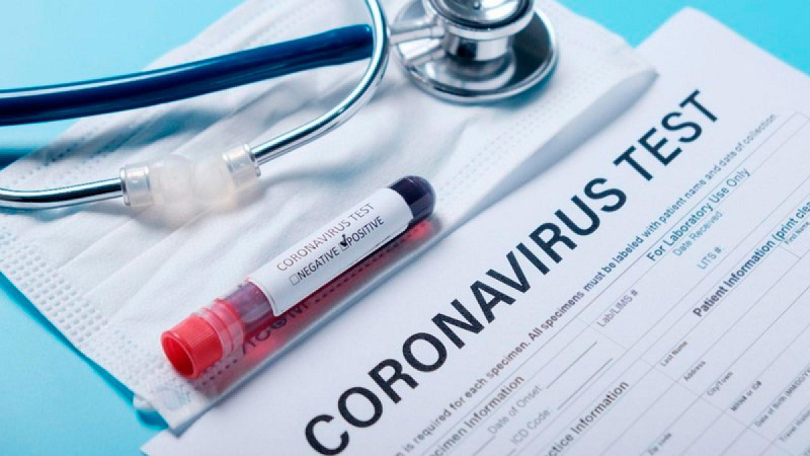 Günün yoluxma və ölüm statistikası <span style=\"color: #ff0000;\">- Koronavirus</span>